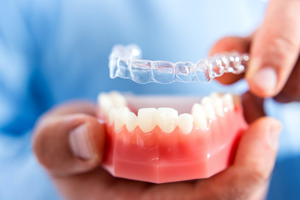 invisalign burnaby, dentist office burnaby