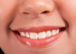 tips for adults to keep teeth healthy, burnaby dentists